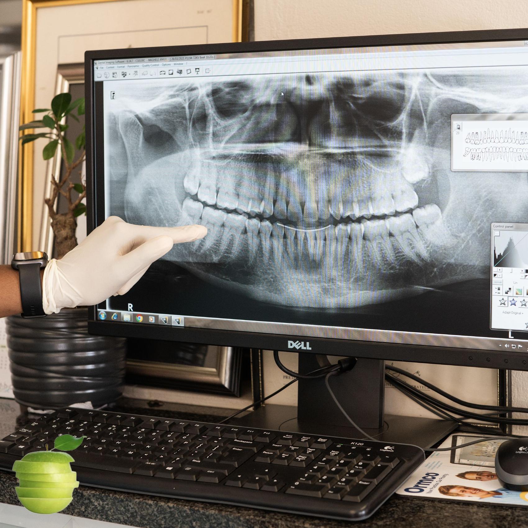 Braceways: Post with a dental X-ray on a monitor