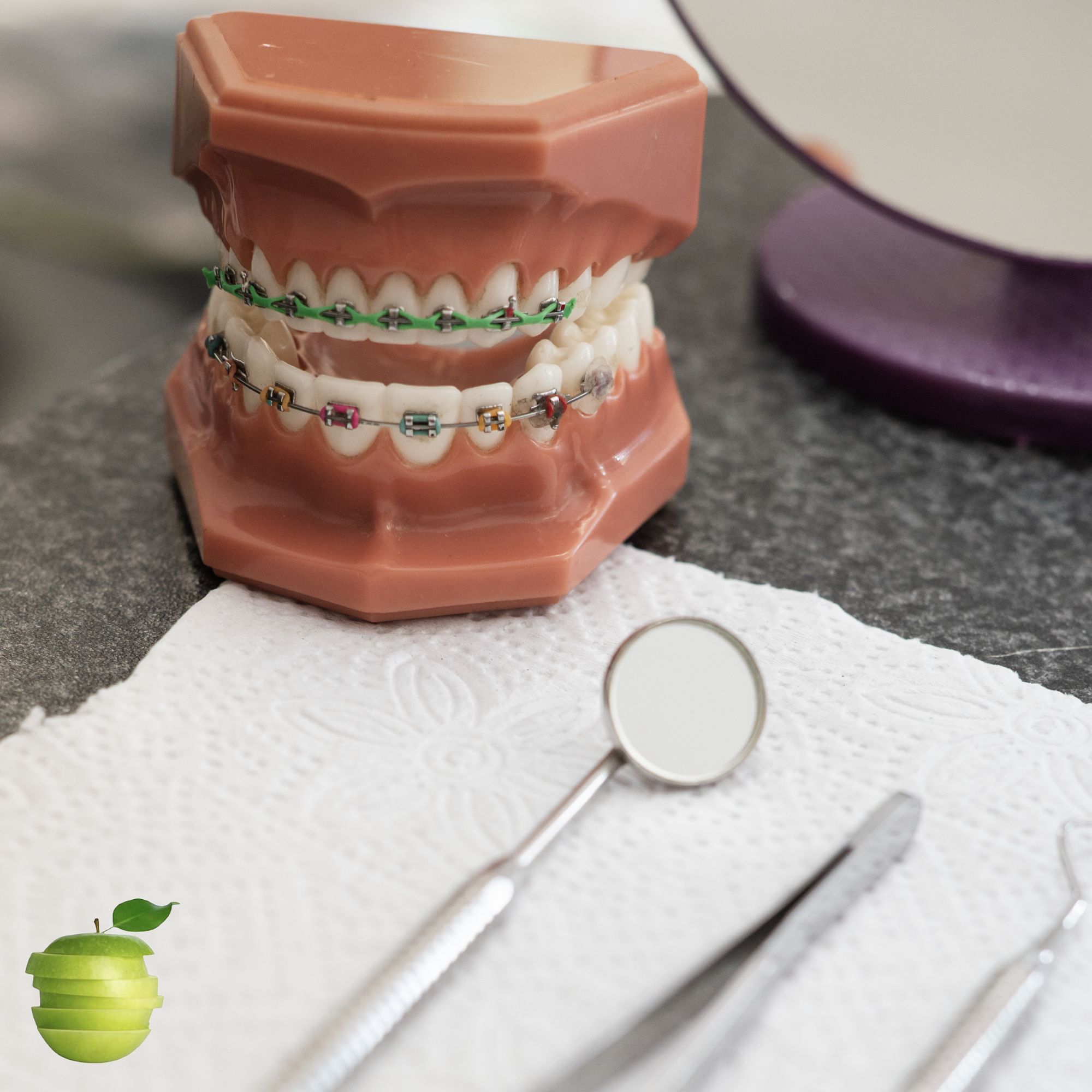 Braceways: Post with a dental model wearing braces beside instruments